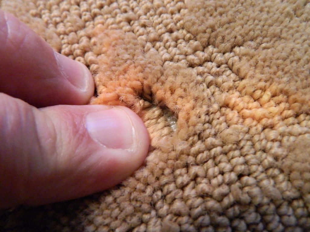 Acne-2-1024-2_218181