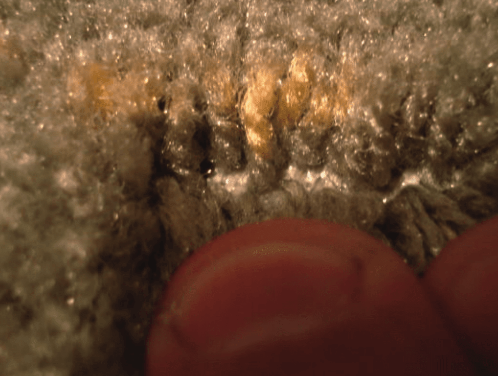 Acne-4-1024-2_678408